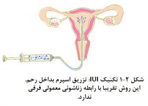ART for infertility treatment fig1-2