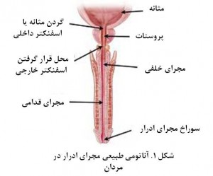 Urethral stricture in men fig 1